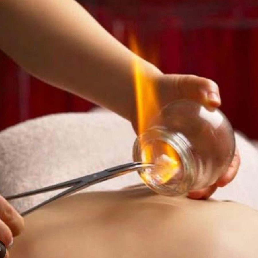 Coppettazione con il fuoco