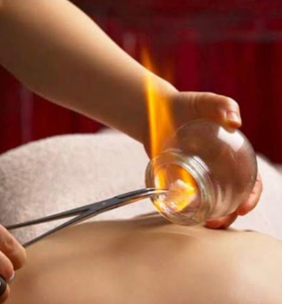 Coppettazione con il fuoco
