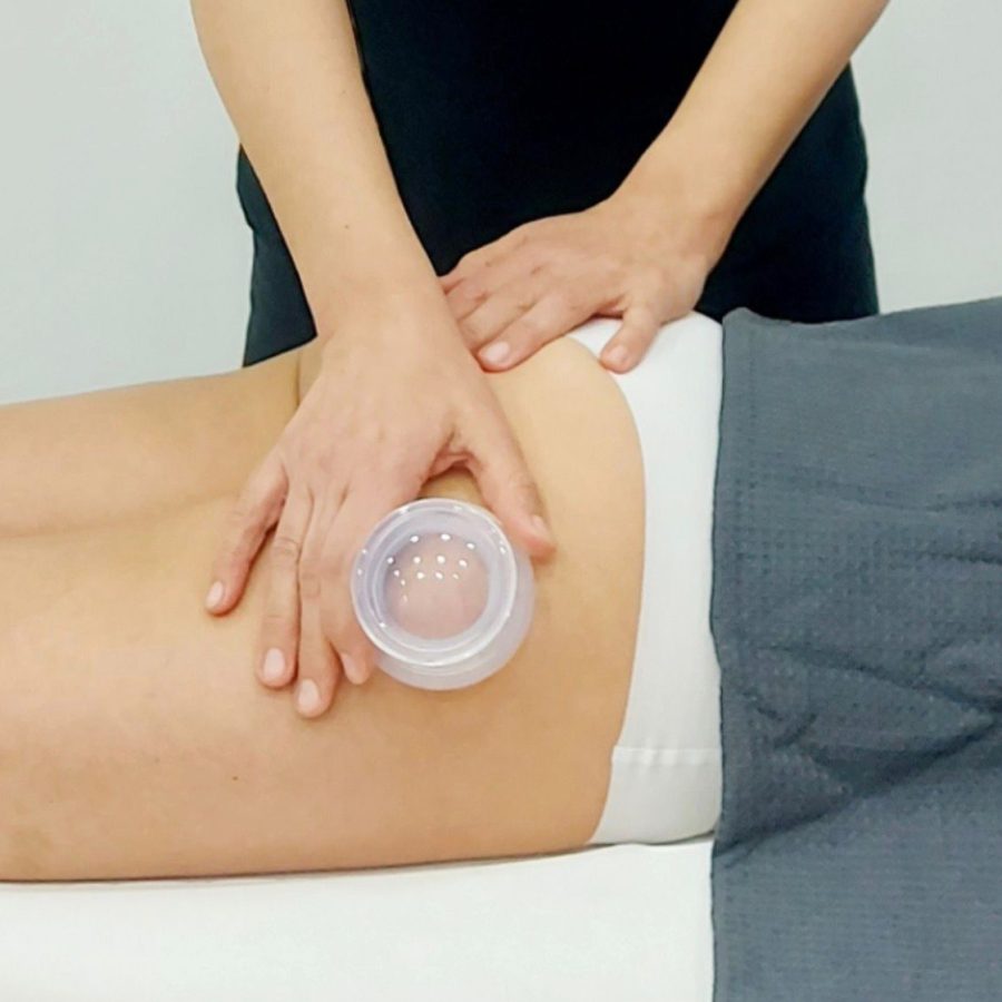 Coppettazione per cellulite