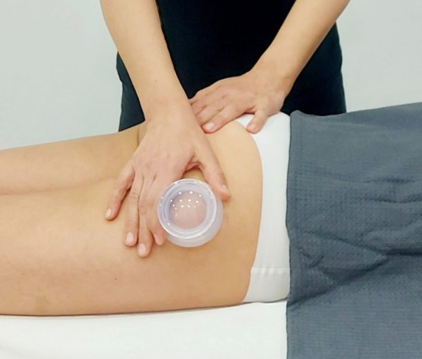 coppettazione-per-cellulite